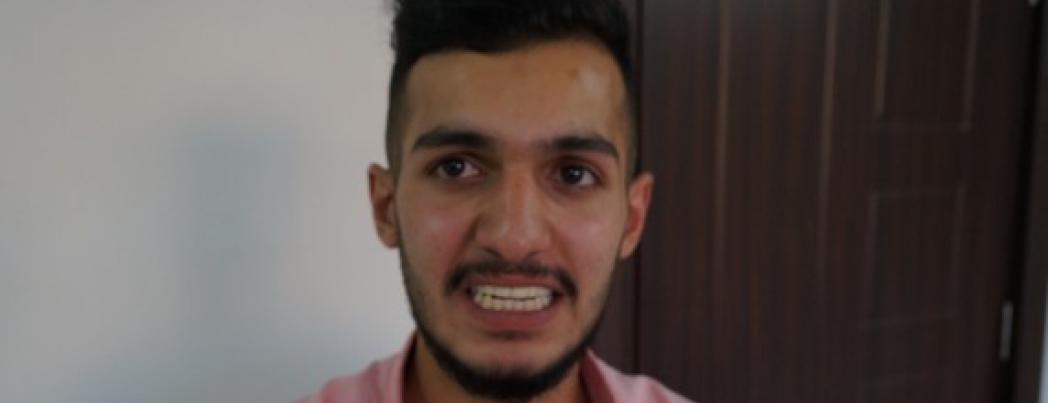 Dolgu için gitti, 11 dişinden oldu
